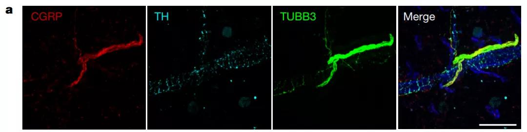 可見神經纖維中（TUBB3）由CGRP標記的傷害感受神經占了大多數